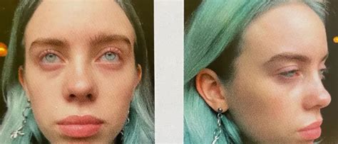 billie eilish leaked pic|Billie Eilish Wore a Pink String Bikini in Summer Photo Dump